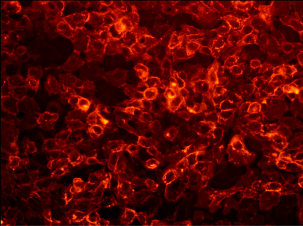IF A431 cells stained with anti-GFP labeled with DSHB antibody DSHB-GFP-4C9 against green fluorescent protein (GFP). Image credit: DSHB. 